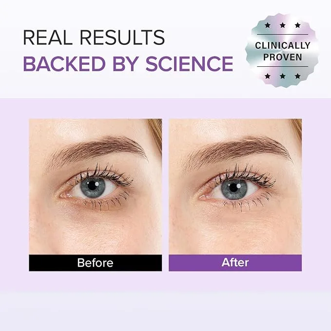 ماري آند ماي ـ كريم العين Tranexamic Acid + Glutathione (طقم خاص: أنبوب 30 غ + هديتان 24 غ) — صورة 3