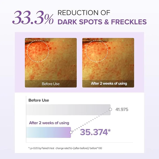 ماري آند ماي ـ كريم العين Tranexamic Acid + Glutathione (طقم خاص: أنبوب 30 غ + هديتان 24 غ) — صورة 7