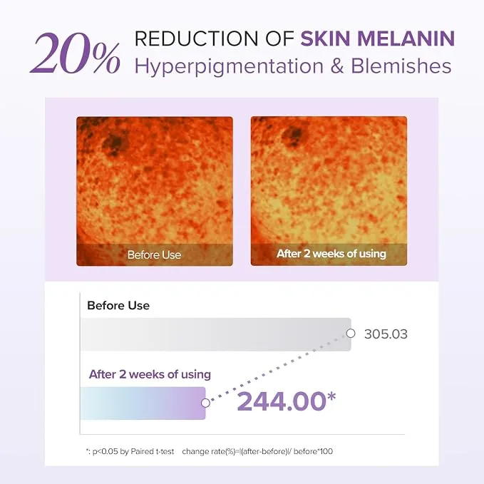 ماري آند ماي ـ كريم العين Tranexamic Acid + Glutathione (طقم خاص: أنبوب 30 غ + هديتان 24 غ) — صورة 5